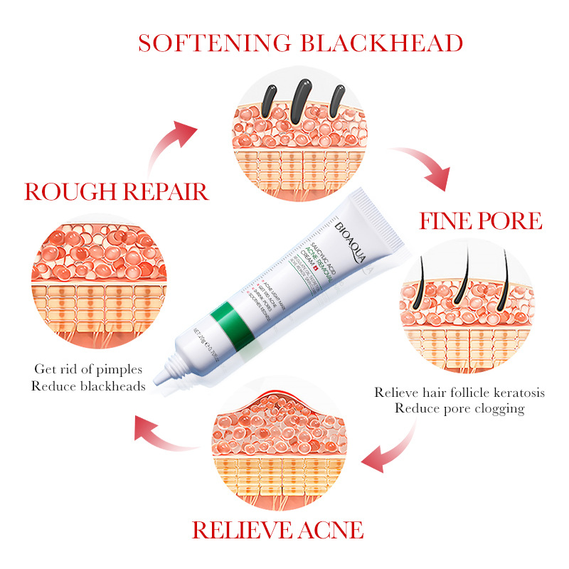 1/2/3pcs BIOAQUA Salicylzuur G - Salicylic Acid Blackhead Remover recensie en prijs