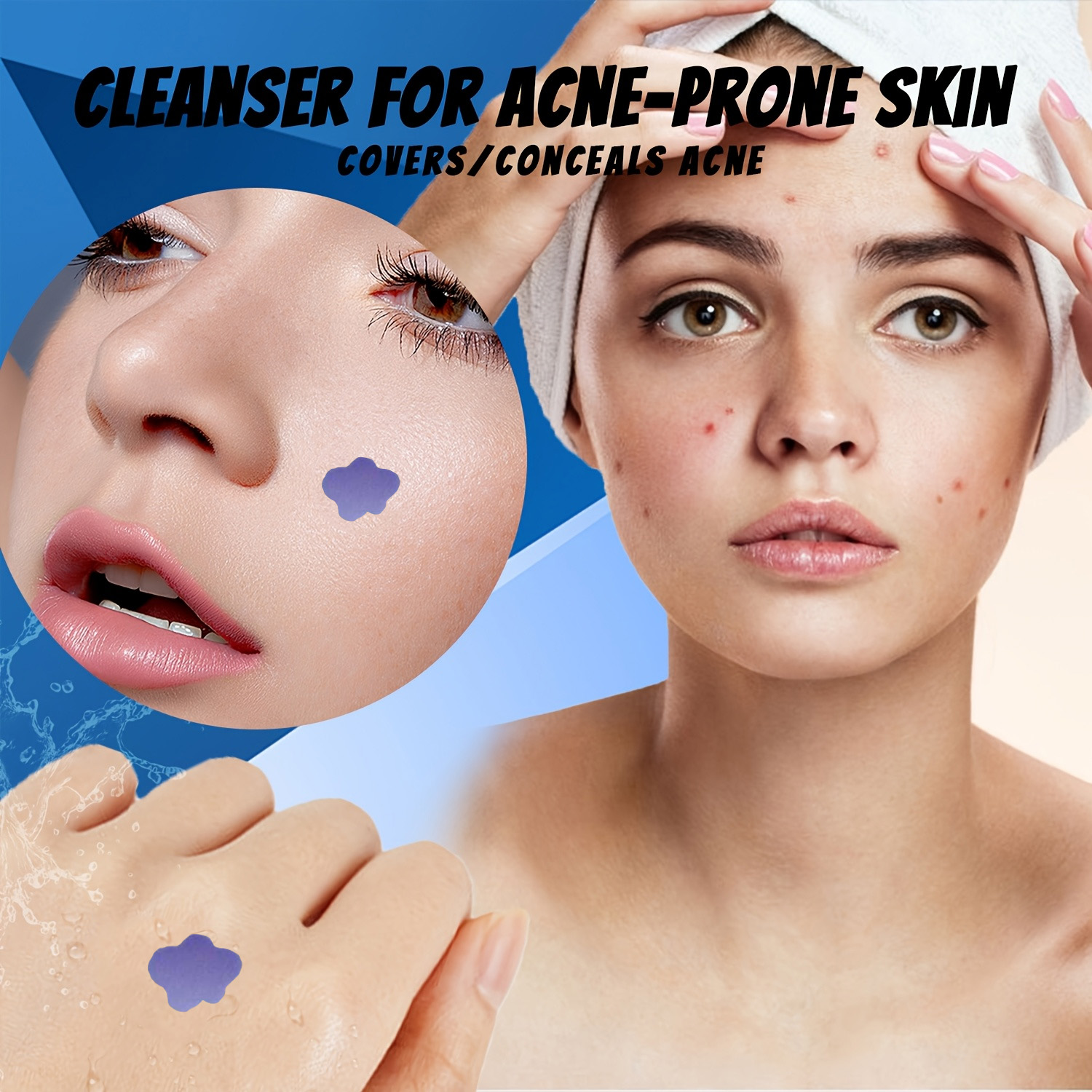 Microneedle Acne Pimple Patch  - Skincare recensie en prijs
