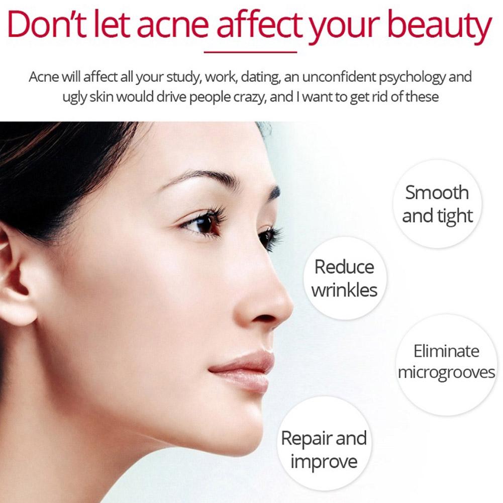 Retinol Lifting Verstevigende  - Retinol Anti Wrinkle Cream recensie en prijs